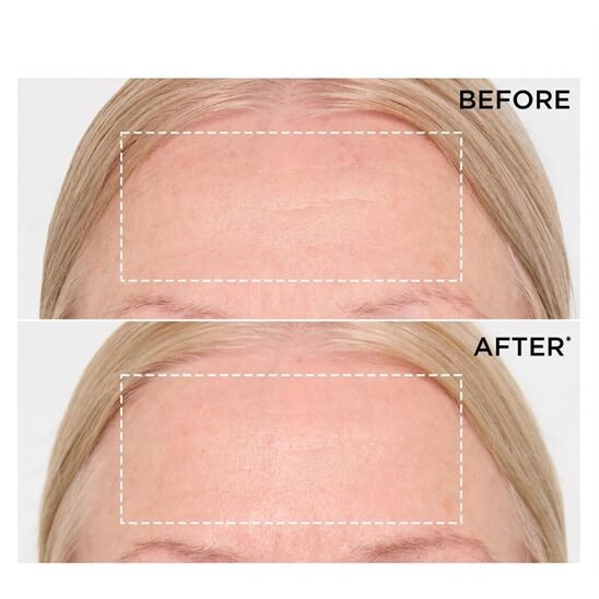 Clarins Double Serum 9 75 ml Yaşlanma Karşıtı Serum - 9