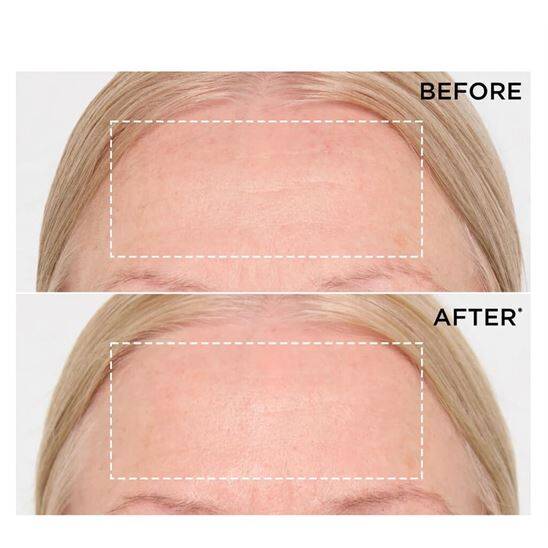 Clarins Double Serum 9 75 ml Yaşlanma Karşıtı Serum - 9