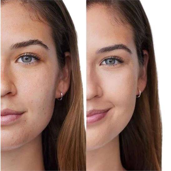 Clinique Acne Solutions Anti-Blemish Fondöten 30 ml CN70 Vanilla - 4