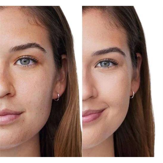 Clinique Acne Solutions Anti-Blemish Fondöten 30 ml CN74 Beige - 4