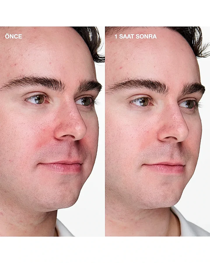 Clinique Anti-Blemish Solutions Clinical 20 ml Sivilce Karşıtı Bakım Jeli - 4