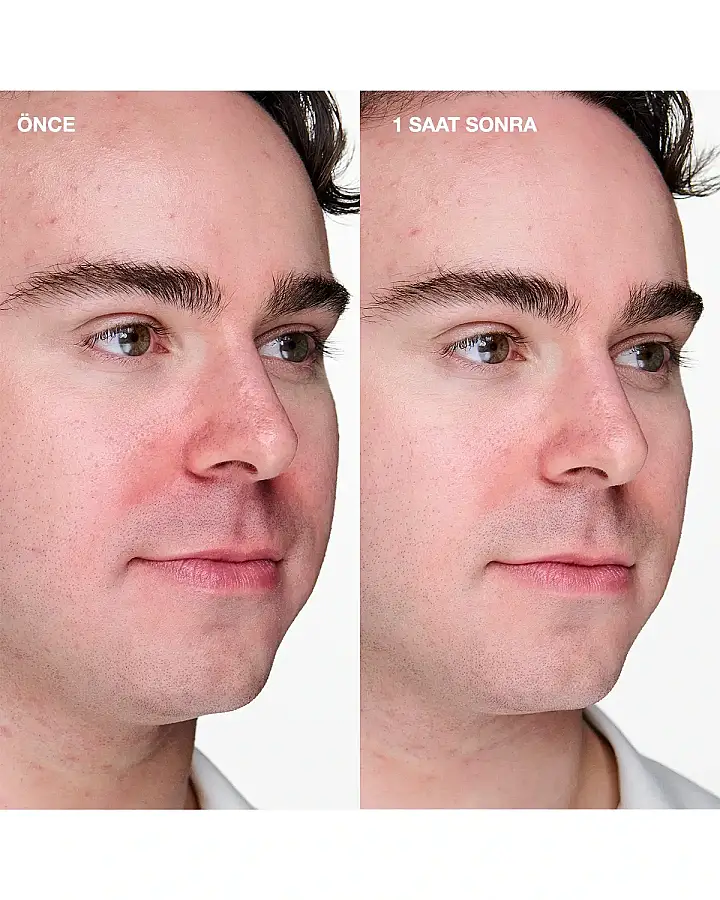 Clinique Anti-Blemish Solutions Clinical 20 ml Sivilce Karşıtı Bakım Jeli - 4