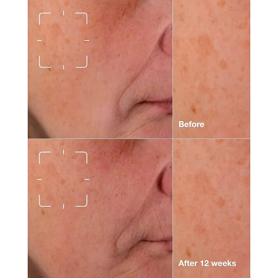 Clinique Even Better Clinical Dark Spot Clearing Serum 30 ml - 5