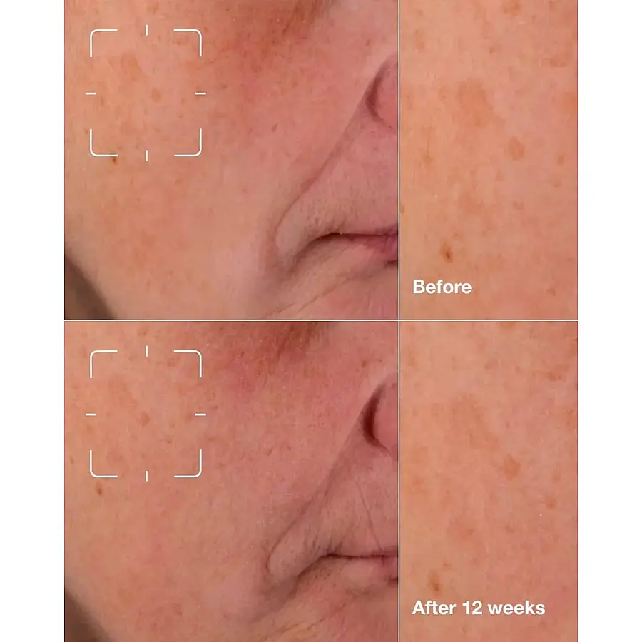 Clinique Even Better Clinical Dark Spot Clearing Serum 30 ml - 5