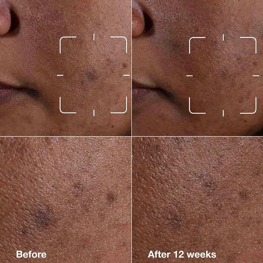 Clinique Even Better Clinical Dark Spot Clearing Serum 30 ml - 6