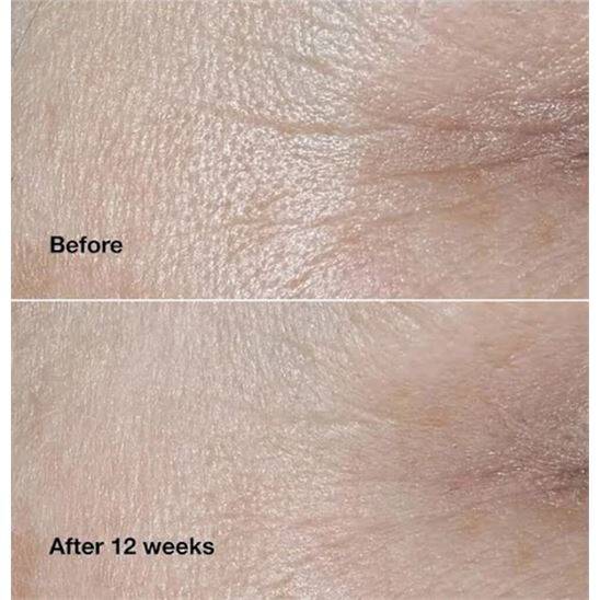 Clinique Smart Clinical Repair 75 ml Kırışıklık Karşıtı Krem - 5