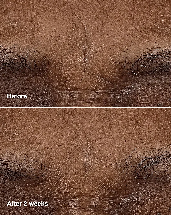 Clinique Smart Clinical Repair Gündüz + Gece Retinol Balm - 5