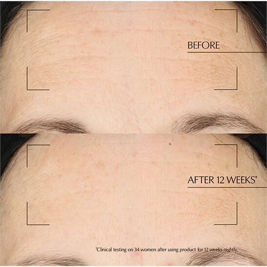 Estee Lauder Advanced Night Repair Overnight Treatment 65 ML Gece Kremi - 4