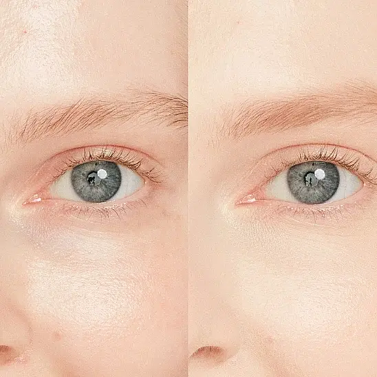 Shiseido Synchro Skin Radiant Lifting Concealer 101 Kapatıcı - 2