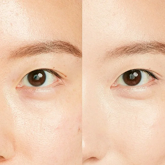 Shiseido Synchro Skin Radiant Lifting Concealer 102 Kapatıcı (1)