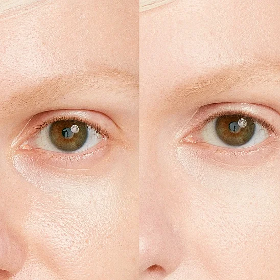 Shiseido Synchro Skin Radiant Lifting Concealer 103 Kapatıcı (1)