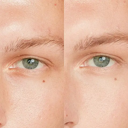 Shiseido Synchro Skin Radiant Lifting Concealer 201 Kapatıcı - 2