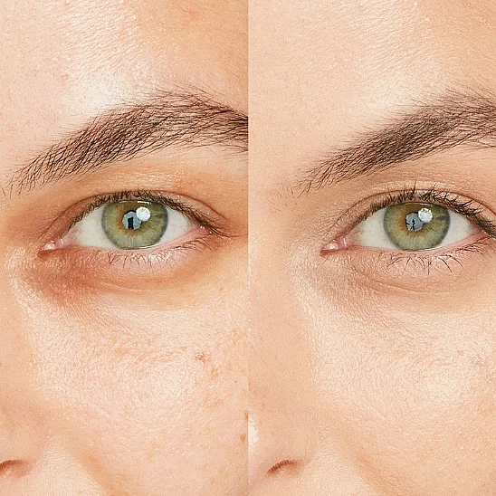 Shiseido Synchro Skin Radiant Lifting Concealer 202 Kapatıcı (1)