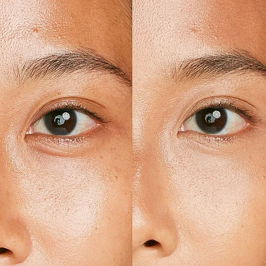 Shiseido Synchro Skin Radiant Lifting Concealer 303 Kapatıcı - 2