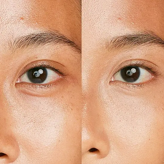 Shiseido Synchro Skin Radiant Lifting Concealer 303 Kapatıcı - 2